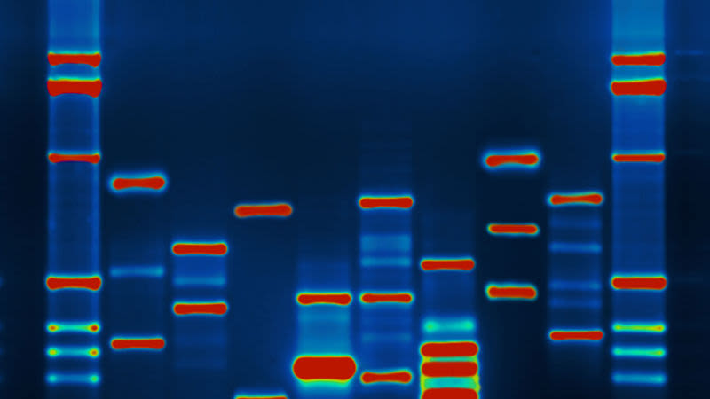 Chỉnh sửa ADN bên trong cơ thể người lần đầu tiên được áp dụng
